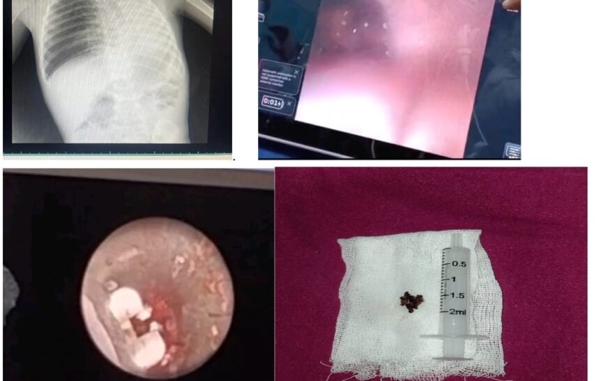 ஒன்றரை வயது குழந்தையின் உயிரைக்காப்பாற்றிய அரசு மருத்துவர்கள் – மக்கள் பாராட்டு