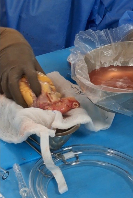 பில்ராத் மருத்துவமனையின் புதிய சேவைகள்